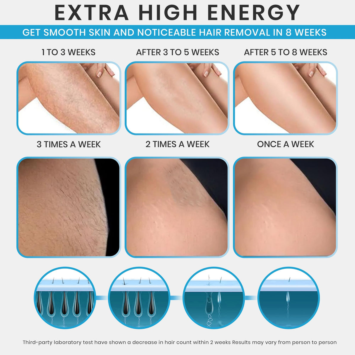 IPL Laser Hair Removal Device for Women & Men (White) R70991